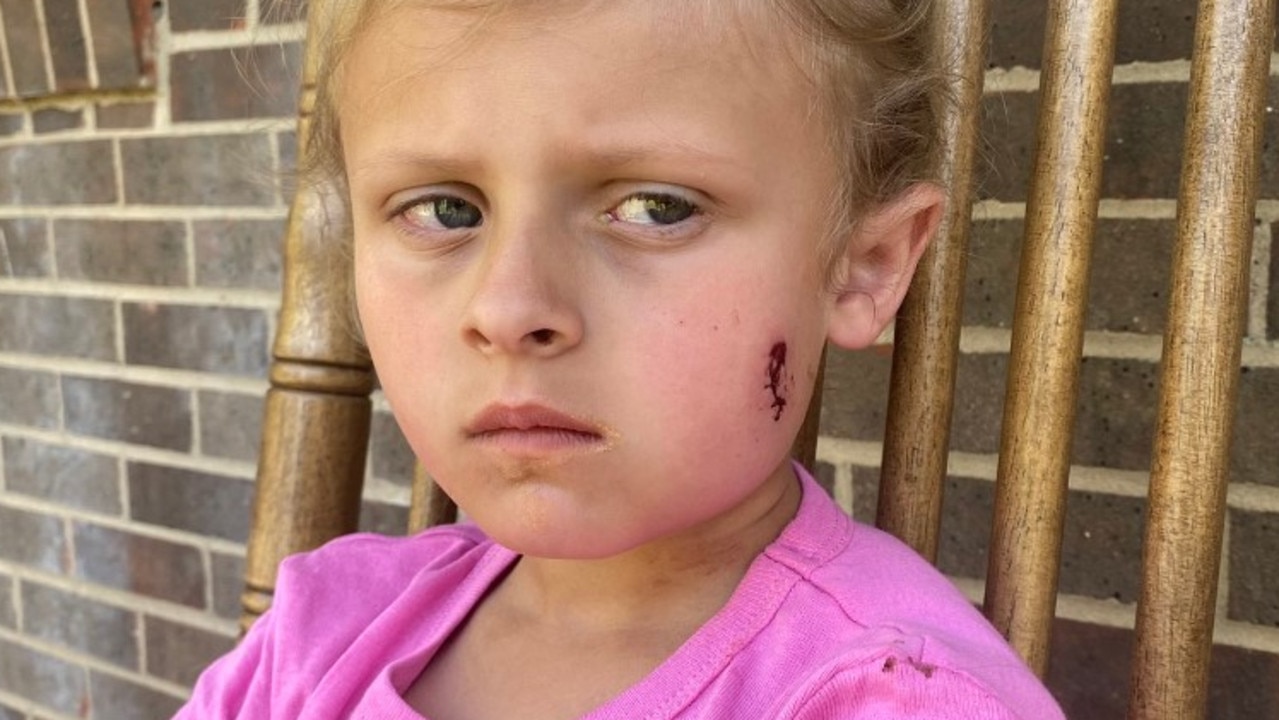 Kinsley White, 6, and her parents allegedly shot by neighbour over a basketball