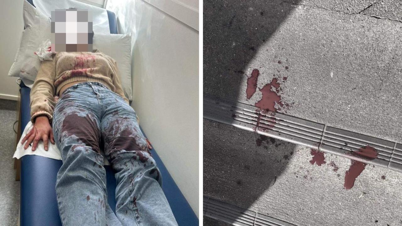 Shocking photo of girl, 12, bashed outside New Zealand McDonald’s