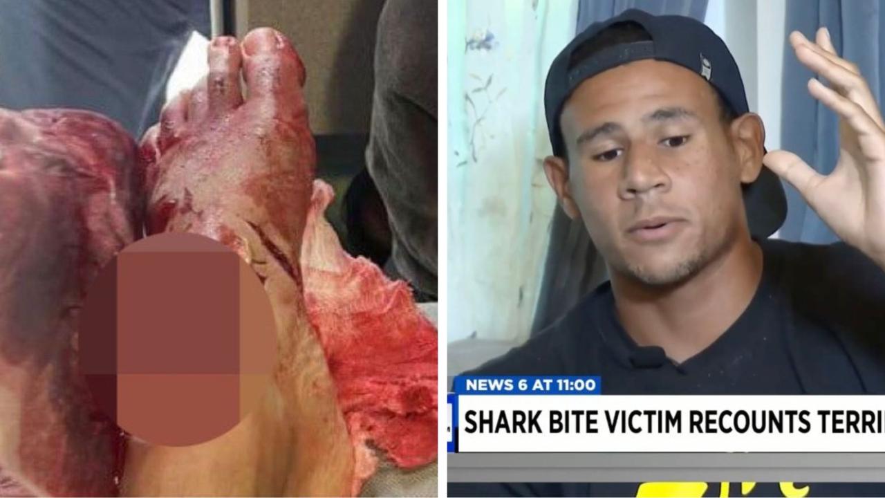 Florida student Chris Pospisil recounts shark attack while surfing