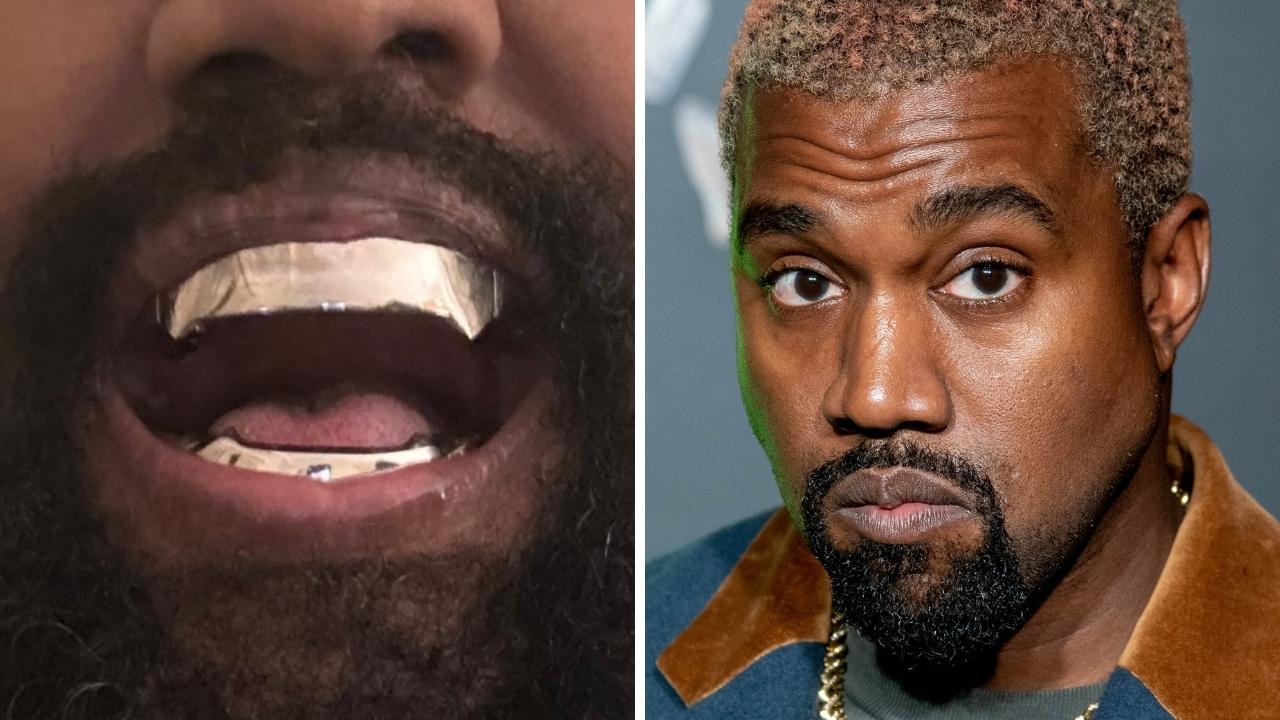 Kanye West’s titanium teeth are permanent, dentist claims