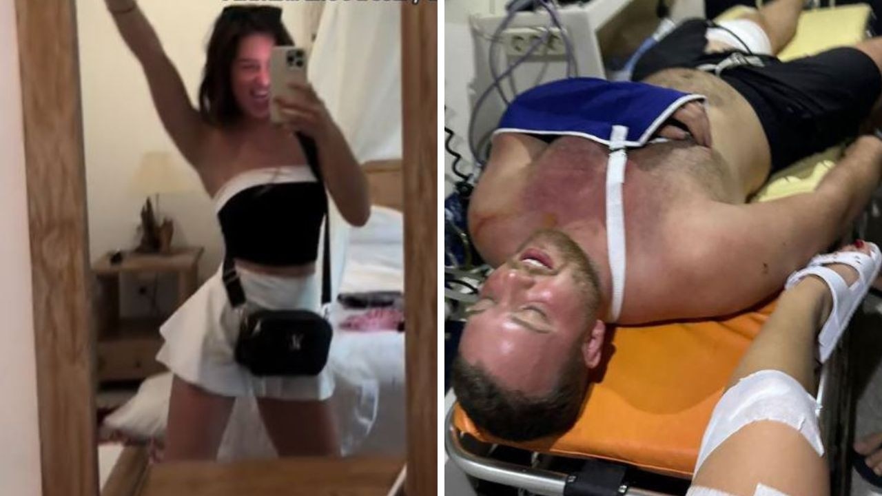 Couple reveal the moments before they were hospitalised in shocking Bali scooter crash